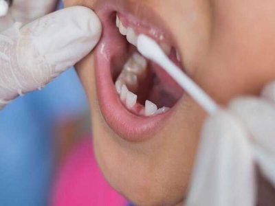 ماده ای که 40 درصد از پوسیدگی دندان پیشگیری می کند