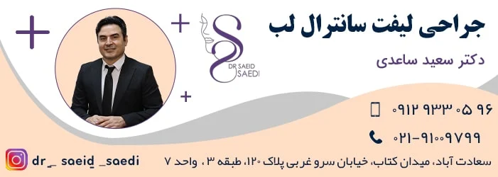 آیا سانترال لب دائمی است