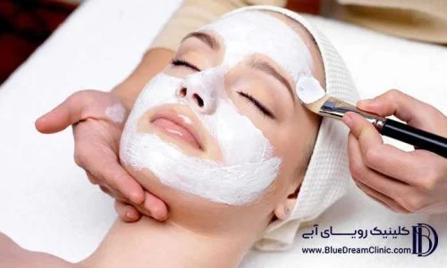 چند نوع فیشیال داریم؟