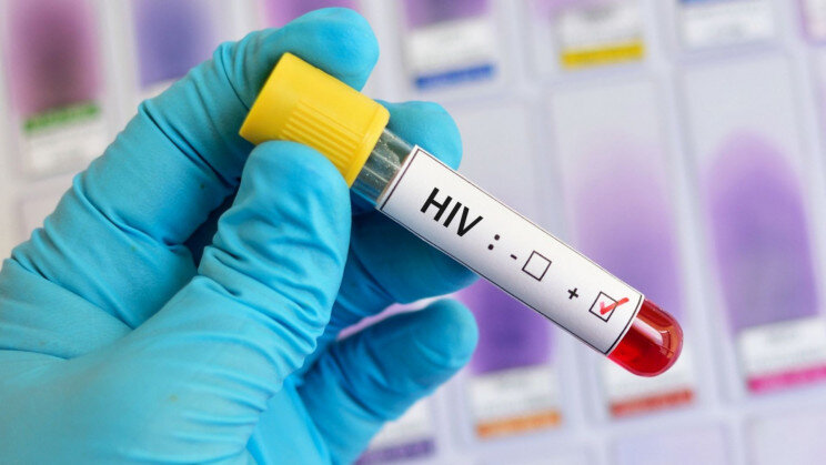 HIV؛ بیماری عفونی و قابل کنترل / تغییر الگوی انتقال HIV از اعتیاد تزریقی به روابط پرخطر