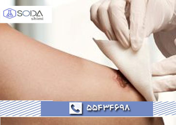 نیترات نقره چیست و چه کاربردی در پزشکی دارد؟